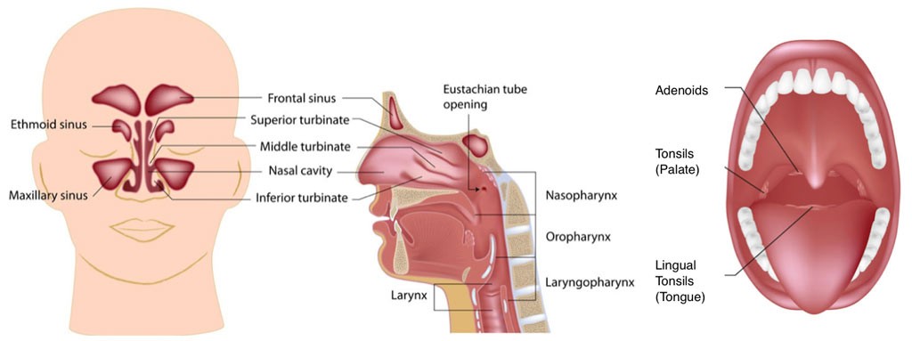 Maxillary Sinus contamination Jaw pain remedy
