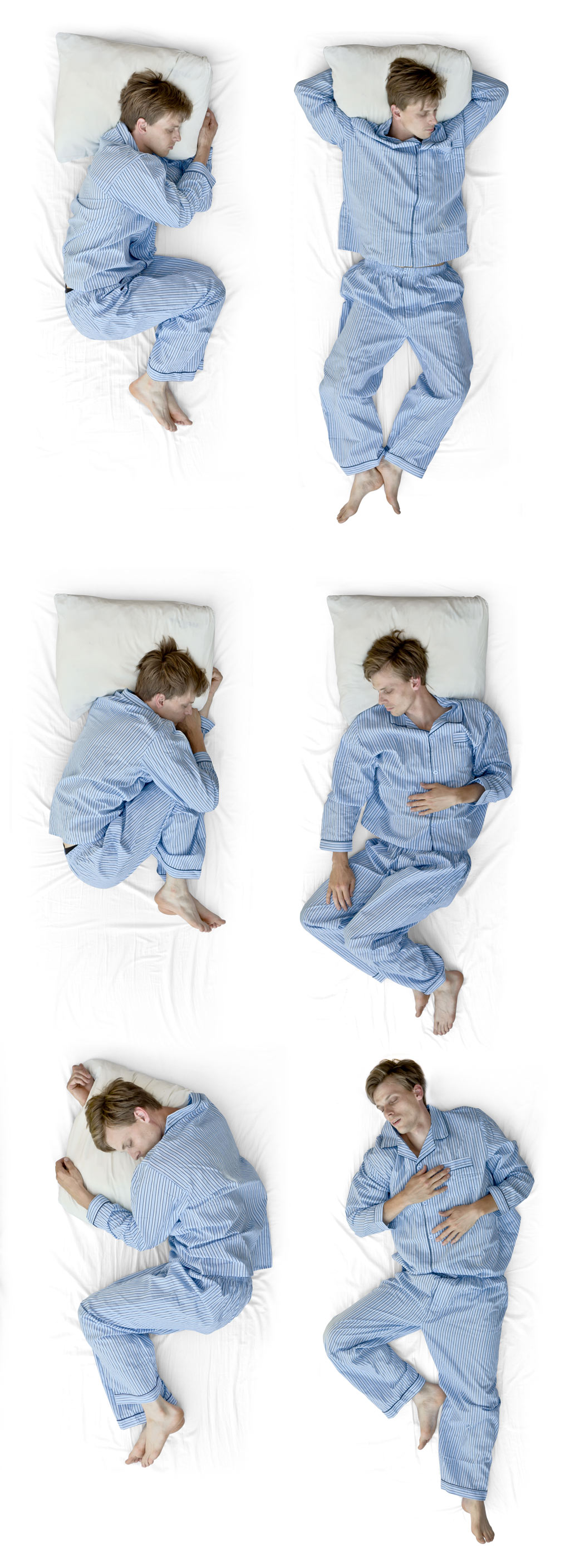 Airway Questionnaire for Obstructive Sleep Apnea (OSA) Larry M