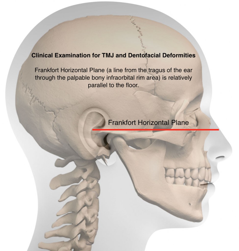 patient-evaluation-for-tmj-dr-larry-m-wolford-dmd